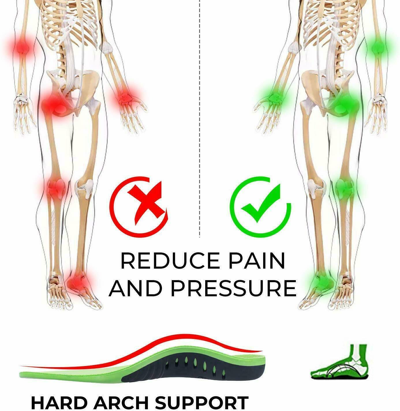 AP Orthotic Inserts - Semi-Custom